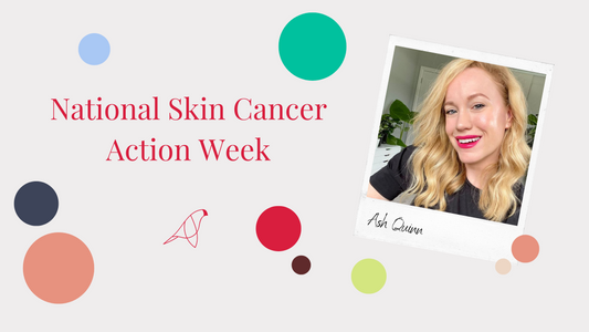 National Skin Cancer Action Week 2022 | Q&A with Ash Quinn